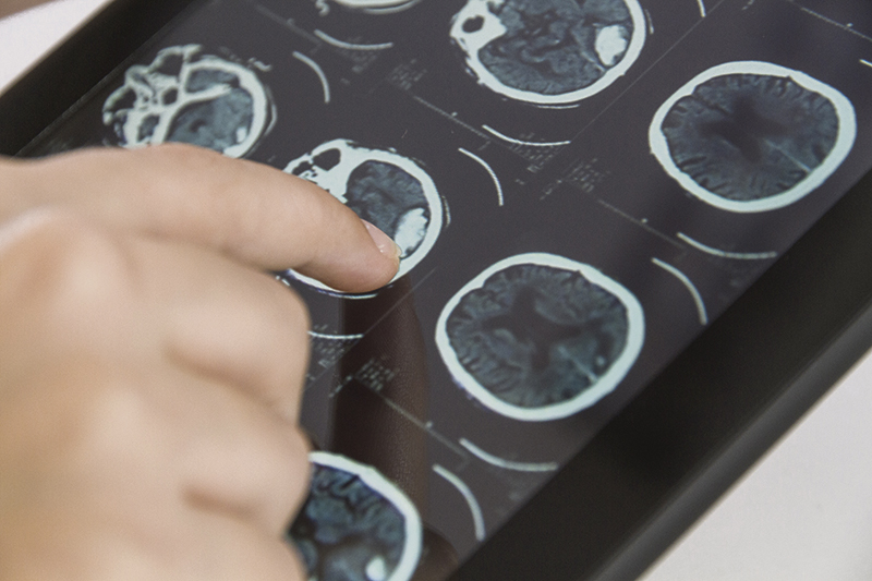 Profesional de la medicina apuntando a una tomografía computarizada con su dedo