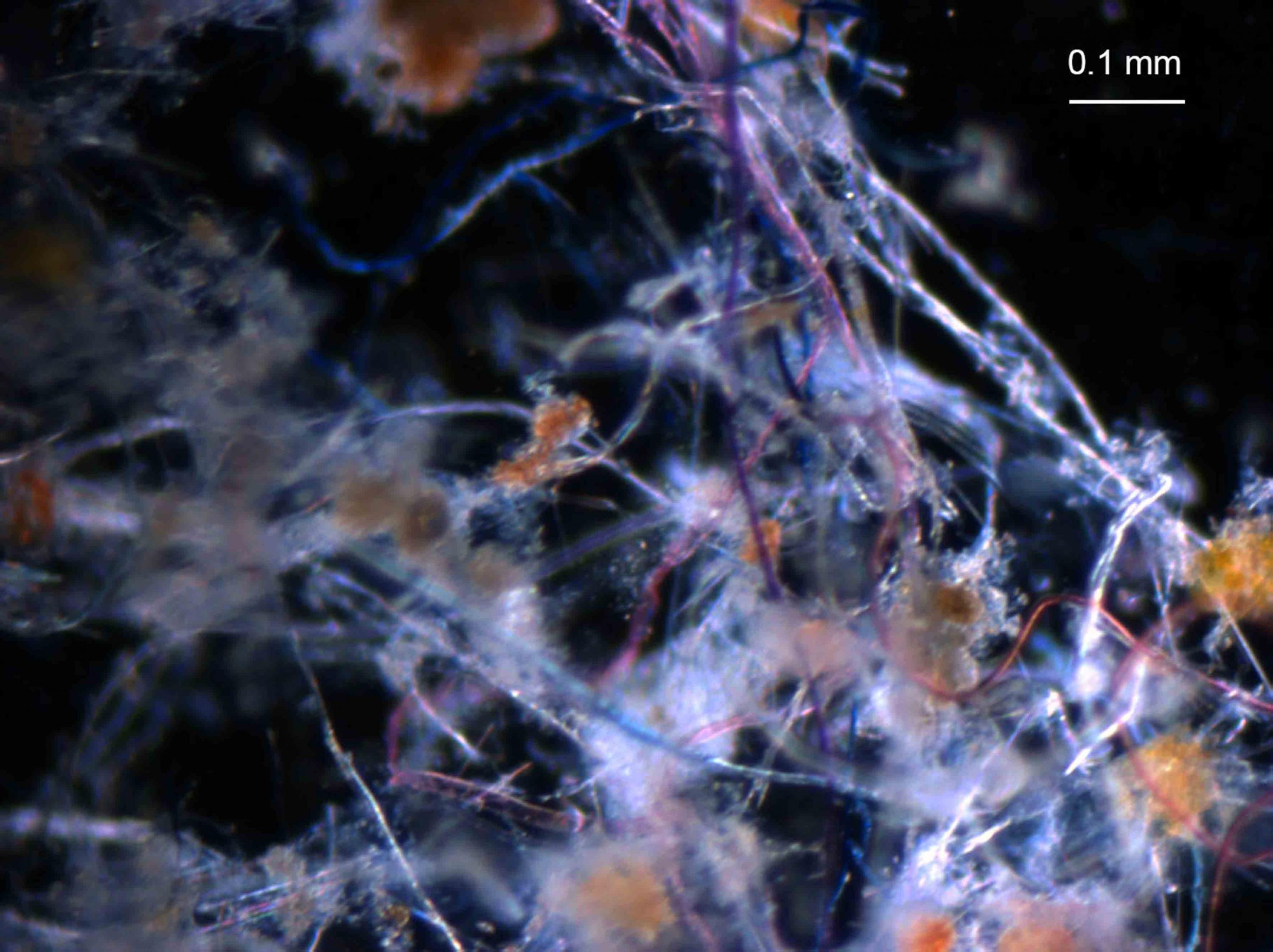 Vista microscopica de los microplasticos existentes en la superficie marina