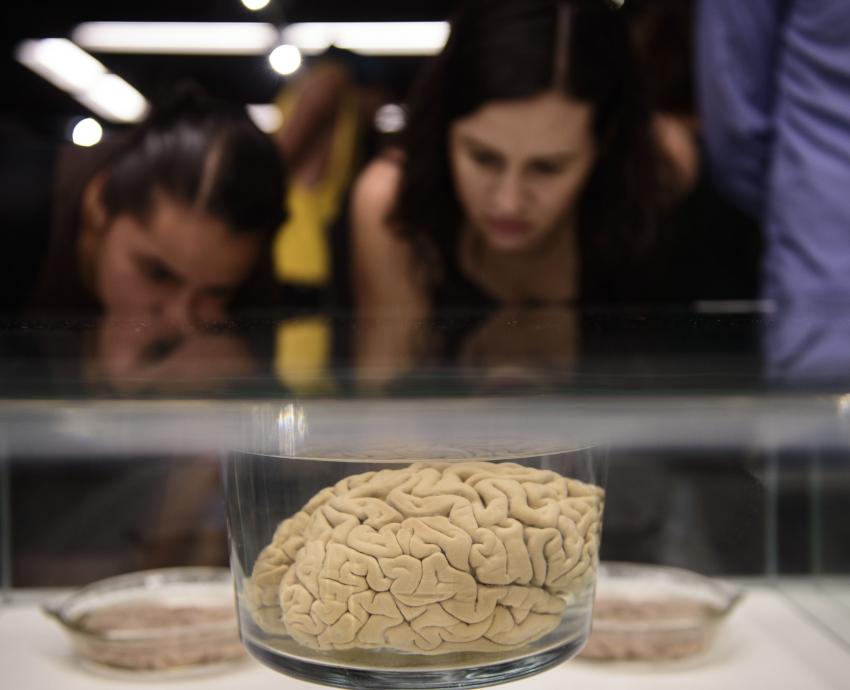 Control de hipertensión y diabetes, fundamental en prevención de enfermedad vascular cerebral