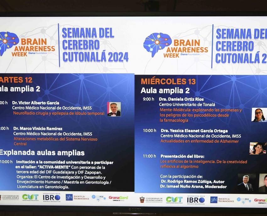 Alimentos hipercalóricos inciden en el desarrollo de enfermedades del cerebro
