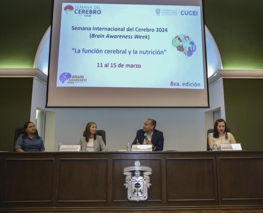 Exceso de azúcares y grasas saturadas comprometen desarrollo de funciones cerebrales