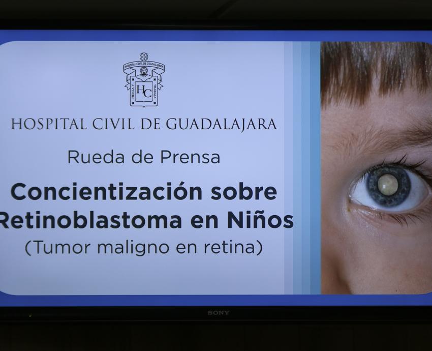 Aumentan casos de cáncer de ojos en niños 