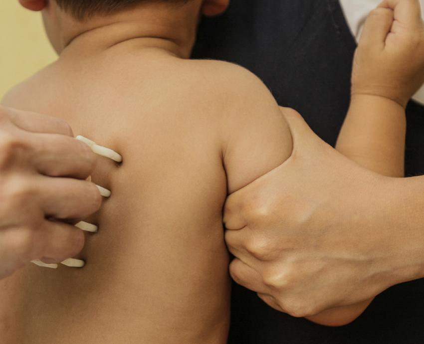 Estiman que hasta dos millones de personas tienen alguna alergia en Jalisco