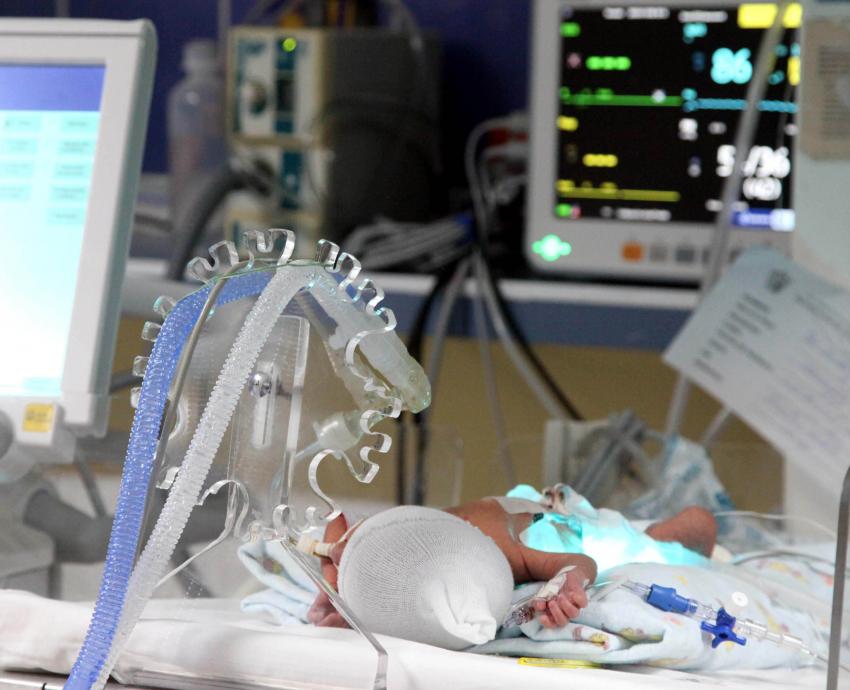 Uno de cada diez bebés en el mundo es prematuro 