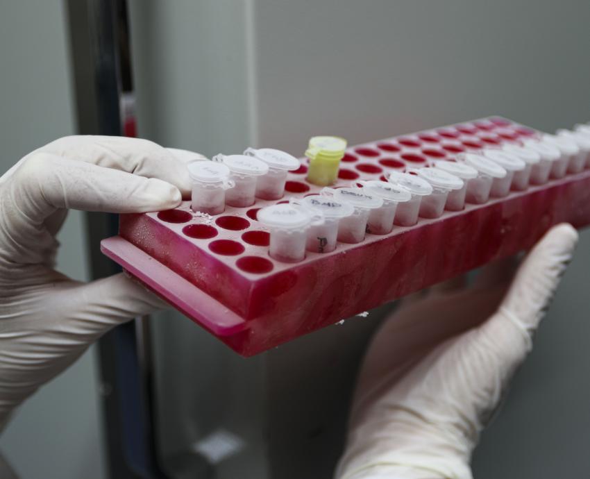 Recomiendan esquema de vacunación completo para prevenir hepatitis B