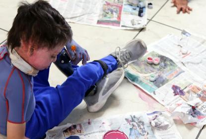 En 20 años beneficiados 4 mil niños con secuelas de quemaduras